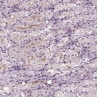 Anti-SLC9A4 Antibody