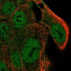 Immunofluorescent staining of human cell line RT4 shows localization to nucleoplasm & plasma membrane.