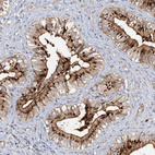 Anti-FGF19 Antibody