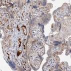 Anti-FGF19 Antibody