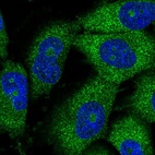 Immunofluorescent staining of human cell line U-251 MG shows localization to nucleoli & cytosol.