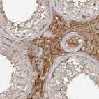 Anti-FGF19 Antibody