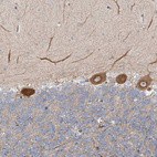 Anti-FGF19 Antibody