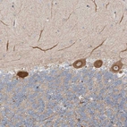 Immunohistochemical staining of human cerebellum shows moderate cytoplasmic positivity in Purkinje cells.