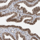 Immunohistochemical staining of human fallopian tube shows moderate to strong nuclear positivity in glandular cells.
