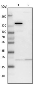 Lane 1: NIH-3T3 cell lysate (Mouse embryonic fibroblast cells)_br/_Lane 2: NBT-II cell lysate (Rat Wistar bladder tumour cells)