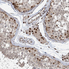 Immunohistochemical staining of human testis shows strong nuclear positivity in Leydig cells.