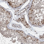 Immunohistochemical staining of human testis shows strong nuclear positivity in Leydig cells.