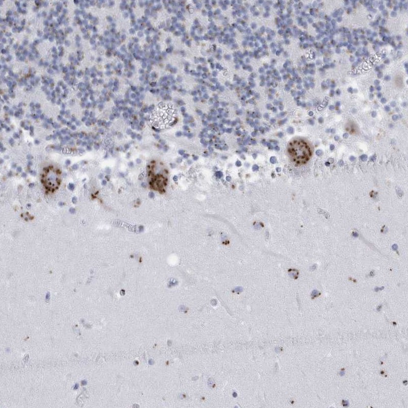 Anti-FAM207A Antibody