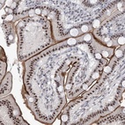 Anti-RBM27 Antibody