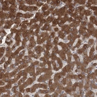 Anti-AASDH Antibody