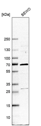 Western blot analysis in human cell line BEWO.