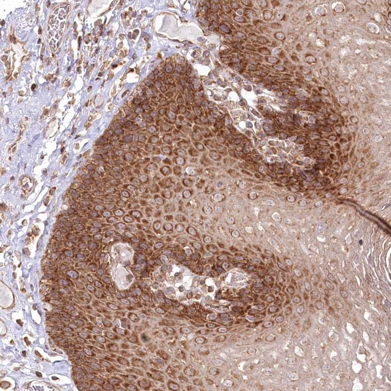 Anti-OTUD4 Antibody