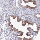 Immunohistochemical staining of human endometrium shows strong membranous positivity in glandular cells.