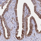 Immunohistochemical staining of human fallopian tube shows strong membranous positivity in glandular cells.