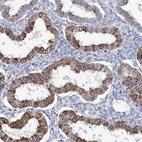 Anti-LRRIQ4 Antibody