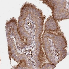 Immunohistochemical staining of human Fallopian tube shows strong membranous and cytoplasmic positivity in glandular cells.