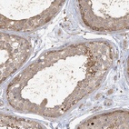 Anti-ANKS1A Antibody