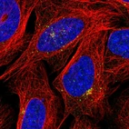 Immunofluorescent staining of human cell line U-2 OS shows localization to vesicles.