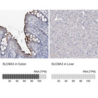 Anti-SLC9A3 Antibody