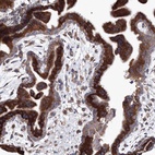 Anti-VPS8 Antibody
