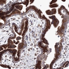 Anti-VPS8 Antibody