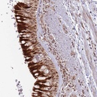 Anti-BOD1L1 Antibody