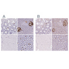 Immunohistochemical staining of human colon, pancreas, skeletal muscle and small intestine using Anti-GCG antibody HPA036761 (A) shows similar protein distribution across tissues to independent antibody HPA036760 (B).
