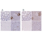 Immunohistochemical staining of human colon, pancreas, skeletal muscle and small intestine using Anti-GCG antibody HPA036761 (A) shows similar protein distribution across tissues to independent antibody HPA036760 (B).