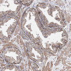 Immunohistochemical staining of human prostate shows moderate to strong granular cytoplasmic positivity in glandular cells.
