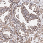Immunohistochemical staining of human prostate shows moderate to strong granular cytoplasmic positivity in glandular cells.