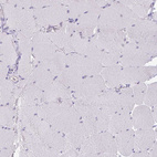 Immunohistochemical staining of human skeletal muscle shows no positivity in myocytes as expected.