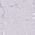 Immunohistochemical staining of human skeletal muscle shows no positivity in myocytes as expected.