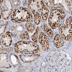 Immunohistochemical staining of human kidney shows moderate to strong granular cytoplasmic positivity in cells in tubules.