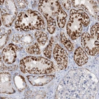 Immunohistochemical staining of human kidney shows moderate to strong granular cytoplasmic positivity in cells in tubules.