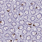 Immunohistochemical staining of human small intestine shows strong cytoplasmic positivity in enteroendocrine cells.