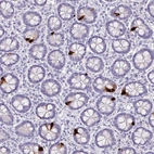 Immunohistochemical staining of human small intestine shows strong cytoplasmic positivity in enteroendocrine cells.