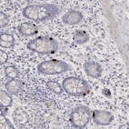 Anti-NEU4 Antibody