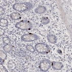 Anti-NEU4 Antibody