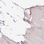 Immunohistochemical staining of human skeletal muscle shows low expression as expected.