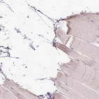 Immunohistochemical staining of human skeletal muscle shows low expression as expected.