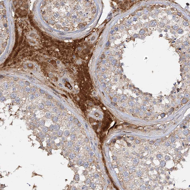 Anti-ARL13A Antibody