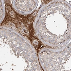 Anti-ARL13A Antibody