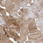 Immunohistochemical staining of human skeletal muscle shows moderate cytoplasmic positivity in myocytes.