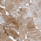 Immunohistochemical staining of human skeletal muscle shows moderate cytoplasmic positivity in myocytes.