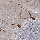 Anti-INPPL1 Antibody
