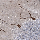 Anti-INPPL1 Antibody