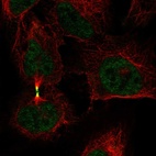 Anti-AURKB Antibody