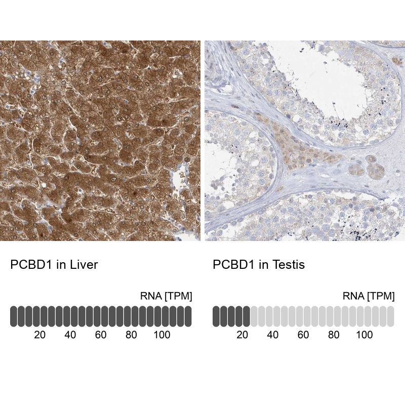 Anti-PCBD1 Antibody