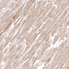 Anti-INPP4B Antibody